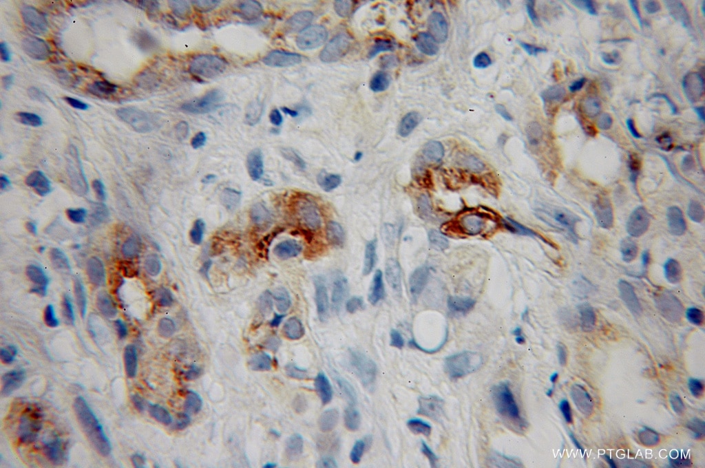 MMP7 Polyclonal antibody