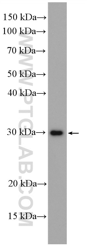 Western Blot (WB) analysis of NIH/3T3 cells using MMP7 Polyclonal antibody (10374-2-AP)
