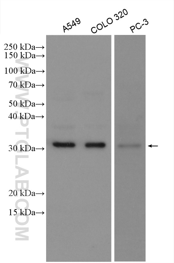 Western Blot (WB) analysis of various lysates using MMP7 Polyclonal antibody (10374-2-AP)