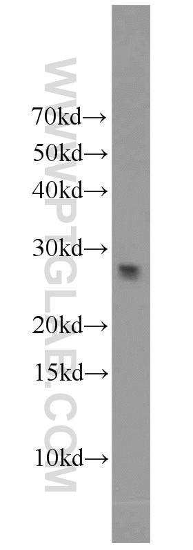 MMP7 Polyclonal antibody