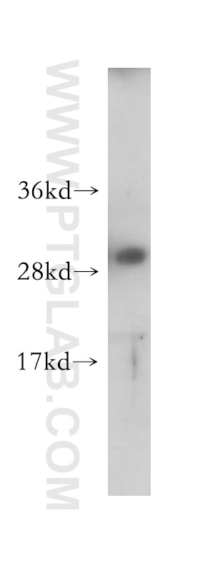 Western Blot (WB) analysis of human placenta tissue using MMP7 Polyclonal antibody (10374-2-AP)