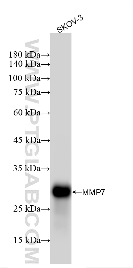 Western Blot (WB) analysis of various lysates using MMP7 Recombinant monoclonal antibody (87552-1-RR)
