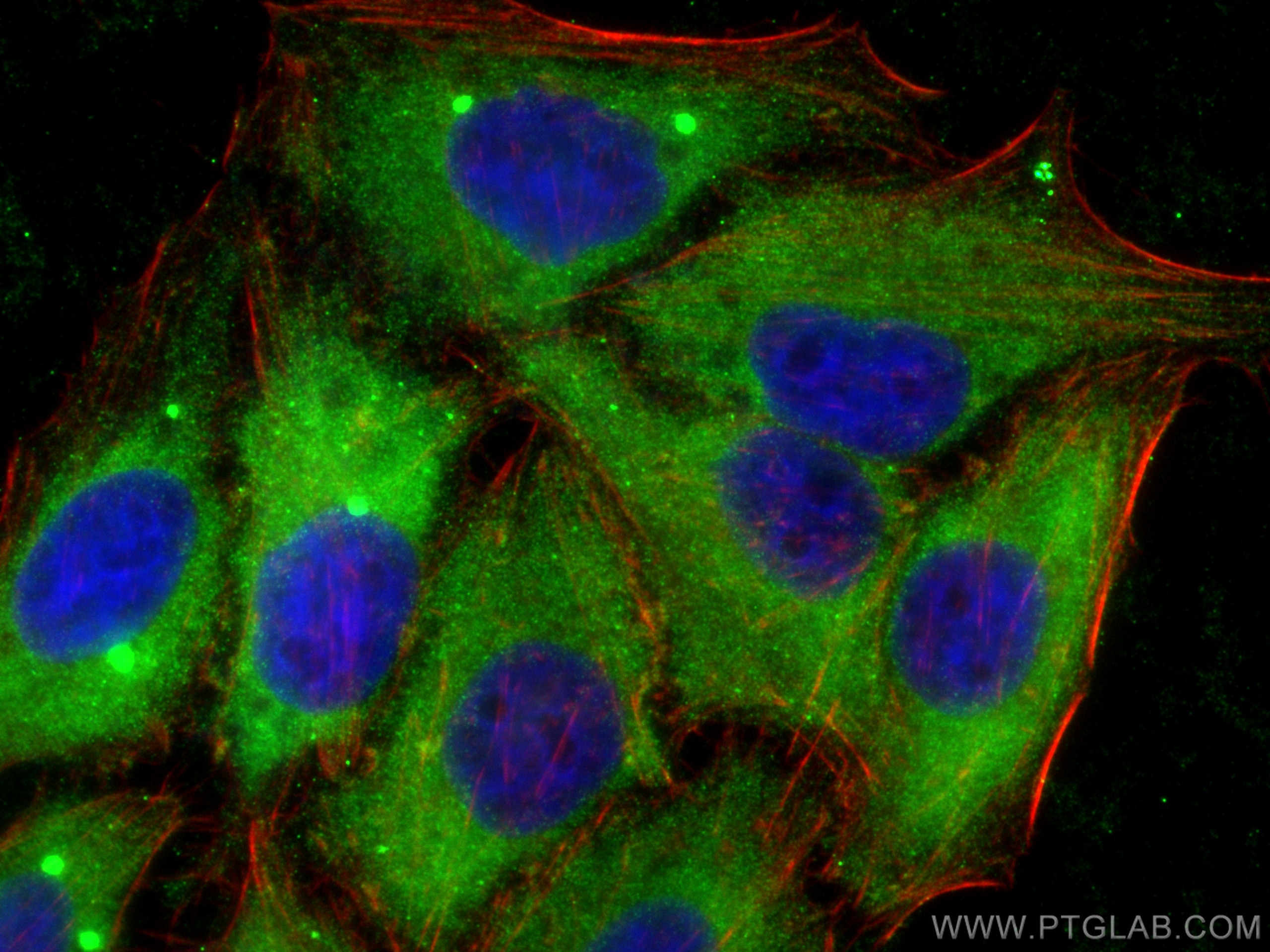 Immunofluorescence (IF) / fluorescent staining of HepG2 cells using MMP8 Polyclonal antibody (17874-1-AP)