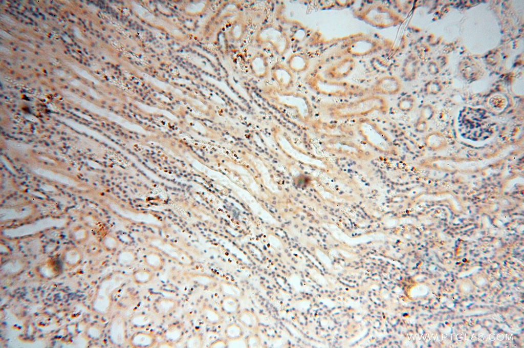 Immunohistochemistry (IHC) staining of human kidney tissue using MMP8 Polyclonal antibody (17874-1-AP)