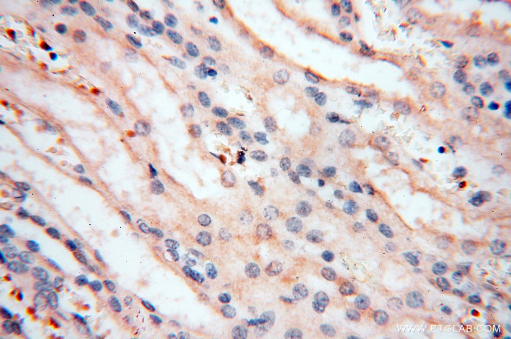 Immunohistochemistry (IHC) staining of human kidney tissue using MMP8 Polyclonal antibody (17874-1-AP)
