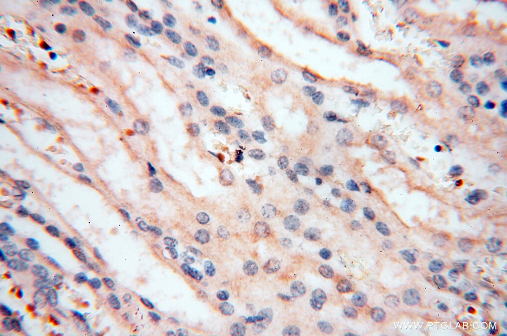 IHC staining of human kidney using 17874-1-AP