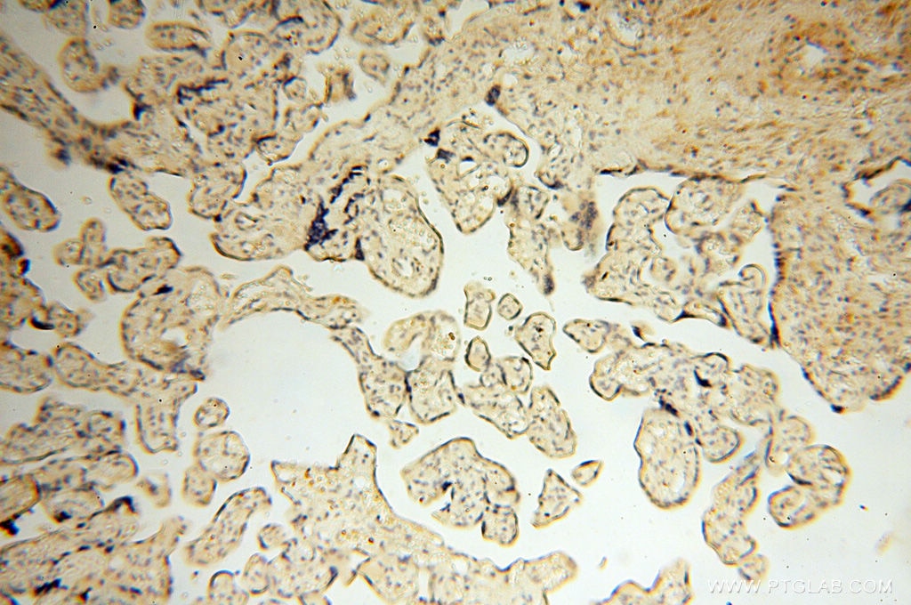 IHC staining of human placenta using 17874-1-AP