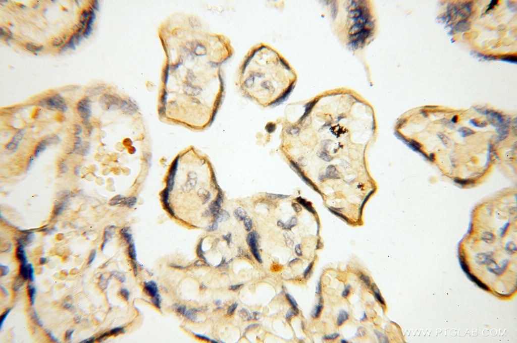 Immunohistochemistry (IHC) staining of human placenta tissue using MMP8 Polyclonal antibody (17874-1-AP)