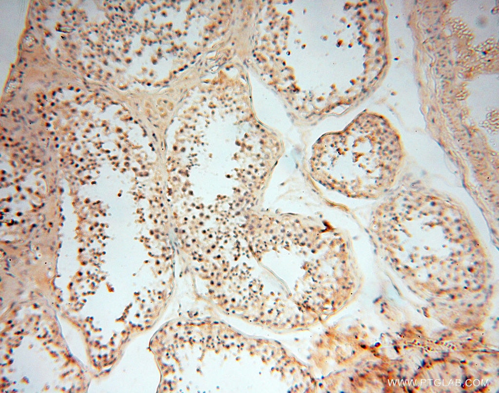 Immunohistochemistry (IHC) staining of human testis tissue using MMP8 Polyclonal antibody (17874-1-AP)