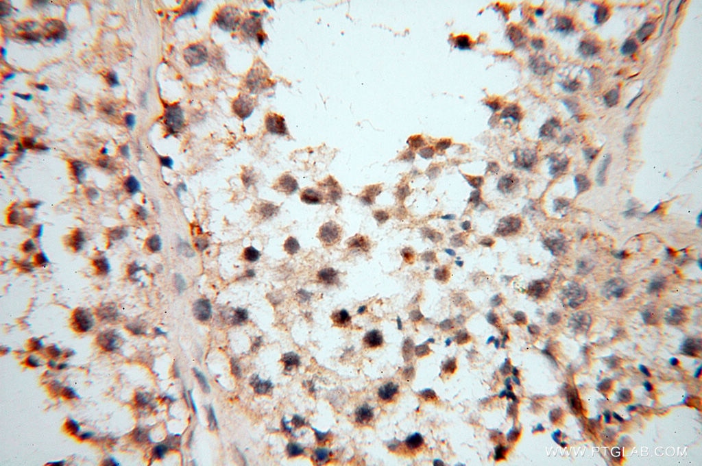 Immunohistochemistry (IHC) staining of human testis tissue using MMP8 Polyclonal antibody (17874-1-AP)