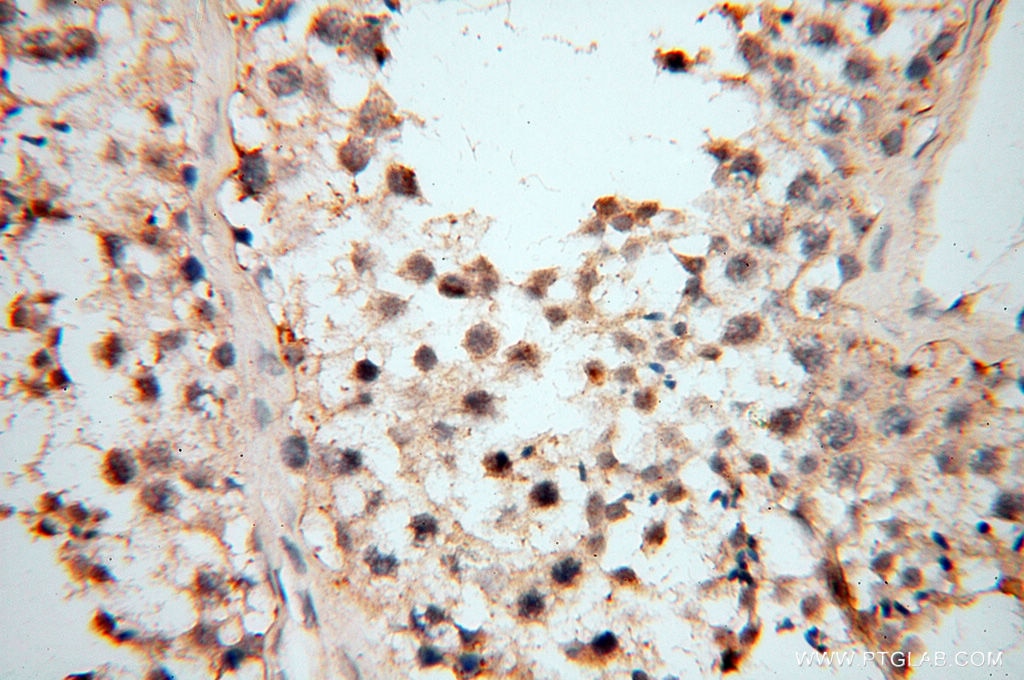 IHC staining of human testis using 17874-1-AP