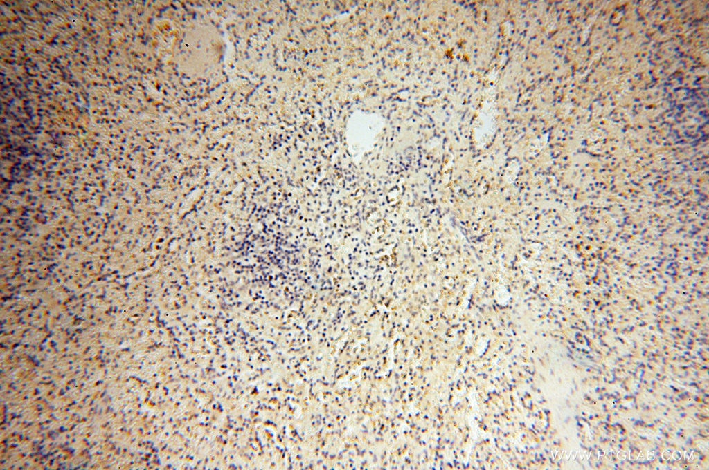 Immunohistochemistry (IHC) staining of human spleen tissue using MMP8 Polyclonal antibody (17874-1-AP)