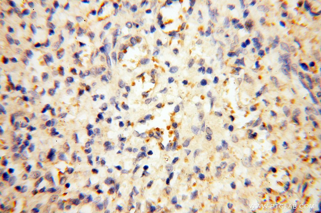 Immunohistochemistry (IHC) staining of human spleen tissue using MMP8 Polyclonal antibody (17874-1-AP)