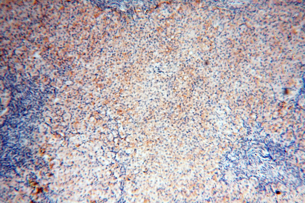 Immunohistochemistry (IHC) staining of human ovary tissue using MMP8 Polyclonal antibody (17874-1-AP)