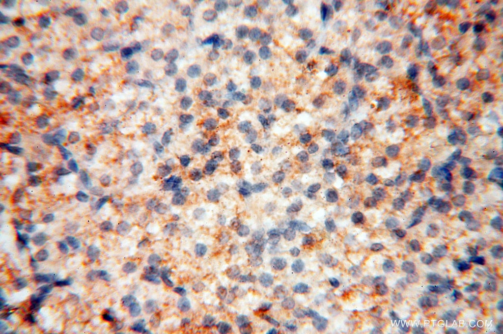 Immunohistochemistry (IHC) staining of human ovary tissue using MMP8 Polyclonal antibody (17874-1-AP)