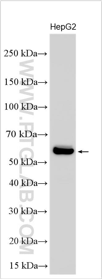 Western Blot (WB) analysis of various lysates using MMP8 Polyclonal antibody (17874-1-AP)