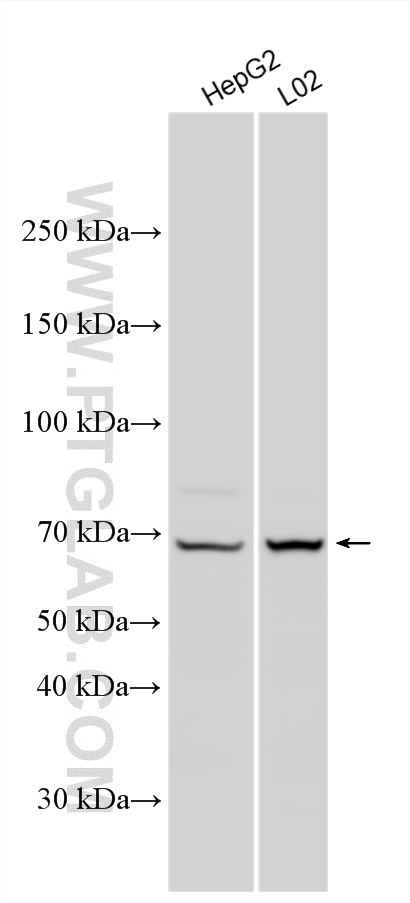 WB analysis using 17874-1-AP Western Blot (WB) analysis of various lysates using MMP8 Polyclonal antibody (17874-1-AP)