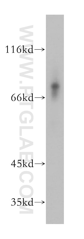 Western Blot (WB) analysis of mouse liver tissue using MMP8 Polyclonal antibody (17874-1-AP)