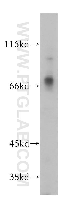 Western Blot (WB) analysis of Jurkat cells using MMP8 Polyclonal antibody (17874-1-AP)