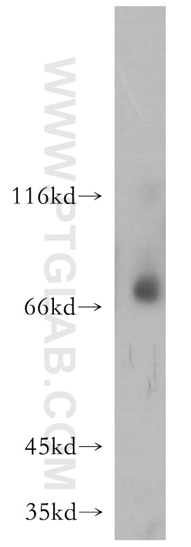 Western Blot (WB) analysis of HepG2 cells using MMP8 Polyclonal antibody (17874-1-AP)