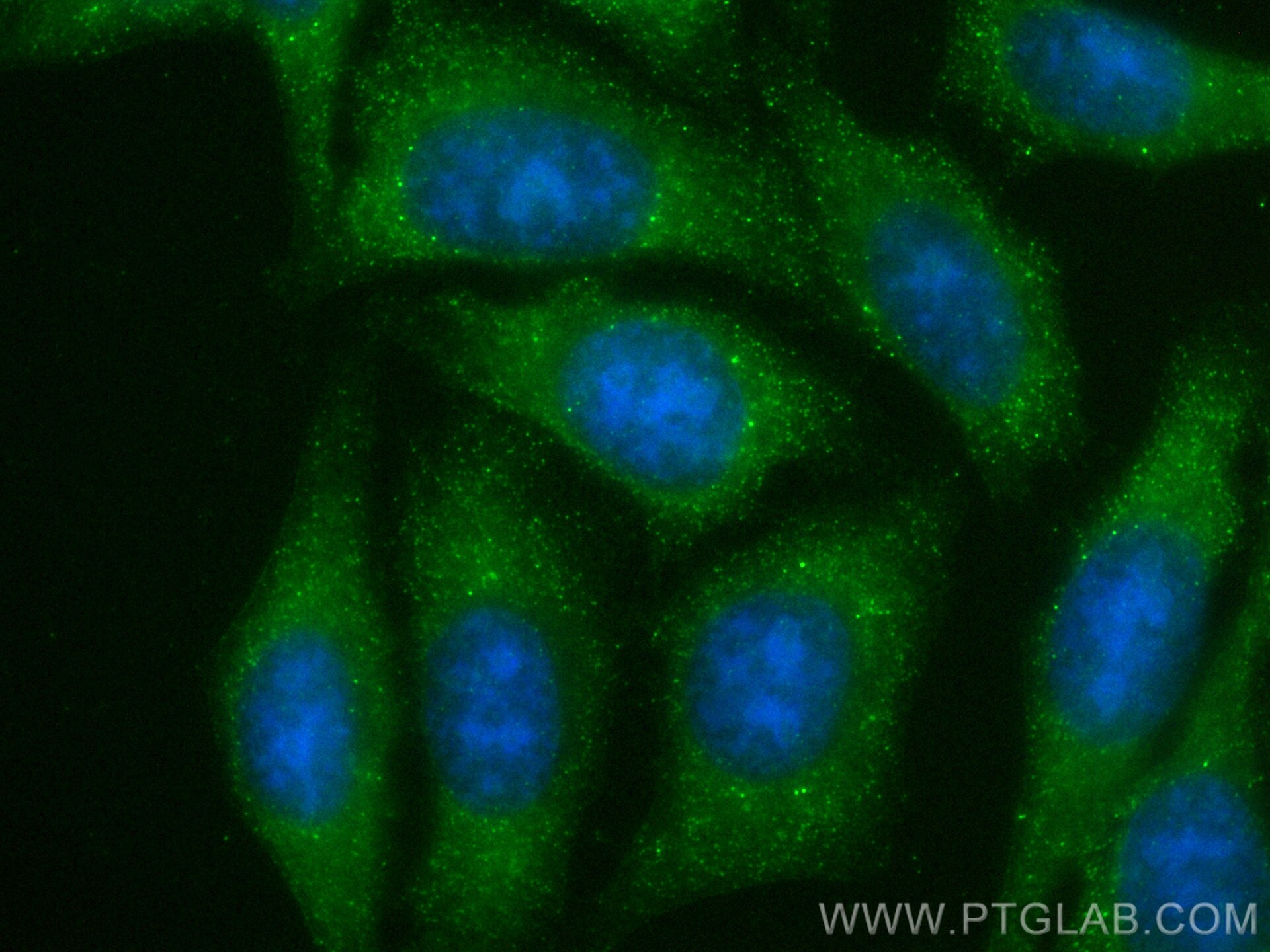 Immunofluorescence (IF) / fluorescent staining of HepG2 cells using MMP8 Recombinant antibody (82885-1-RR)