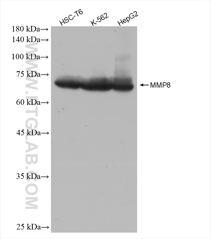 Western Blot (WB) analysis of various lysates using MMP8 Recombinant antibody (82885-1-RR)