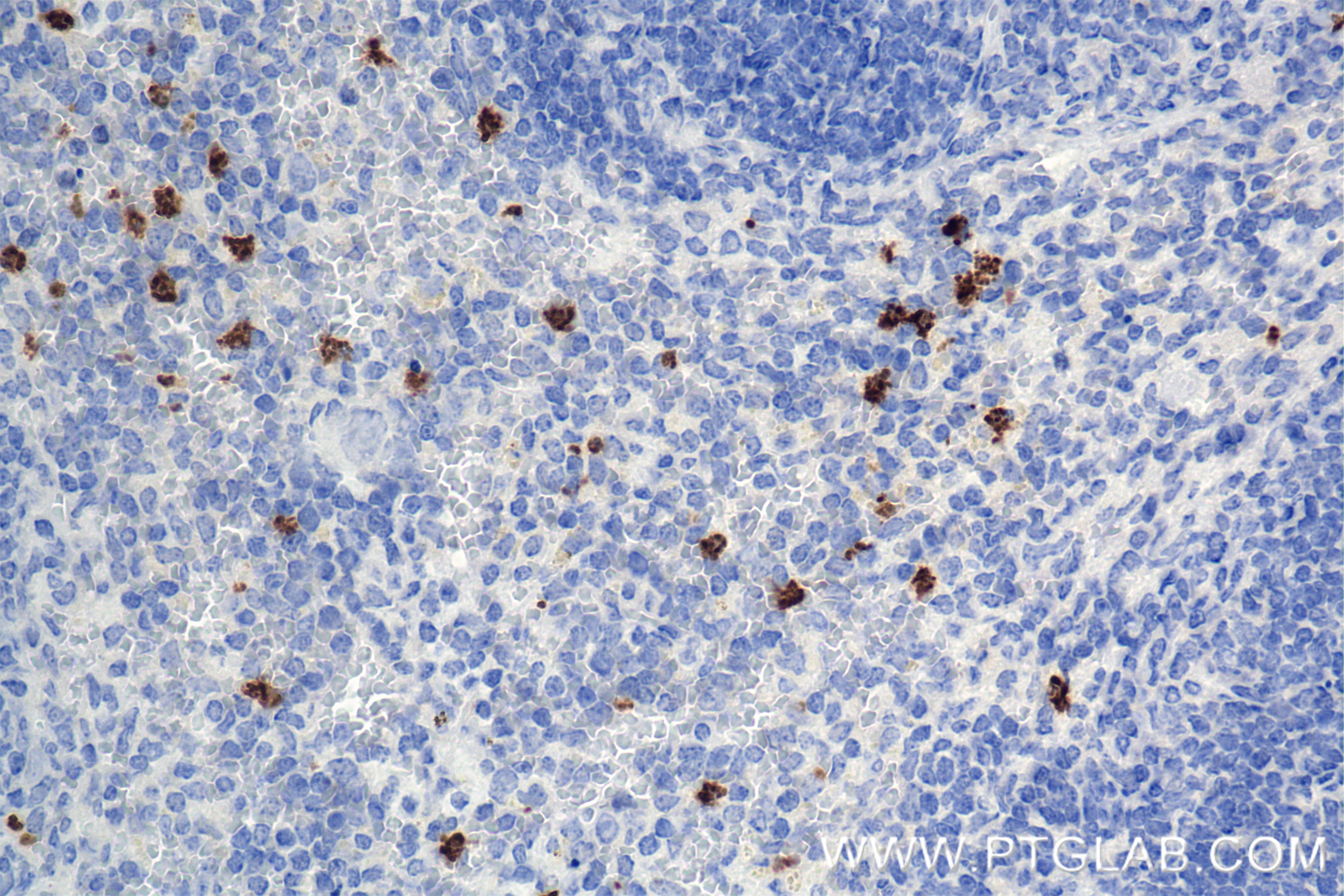Immunohistochemistry (IHC) staining of mouse spleen tissue using MMP8 Recombinant monoclonal antibody (85211-4-RR)