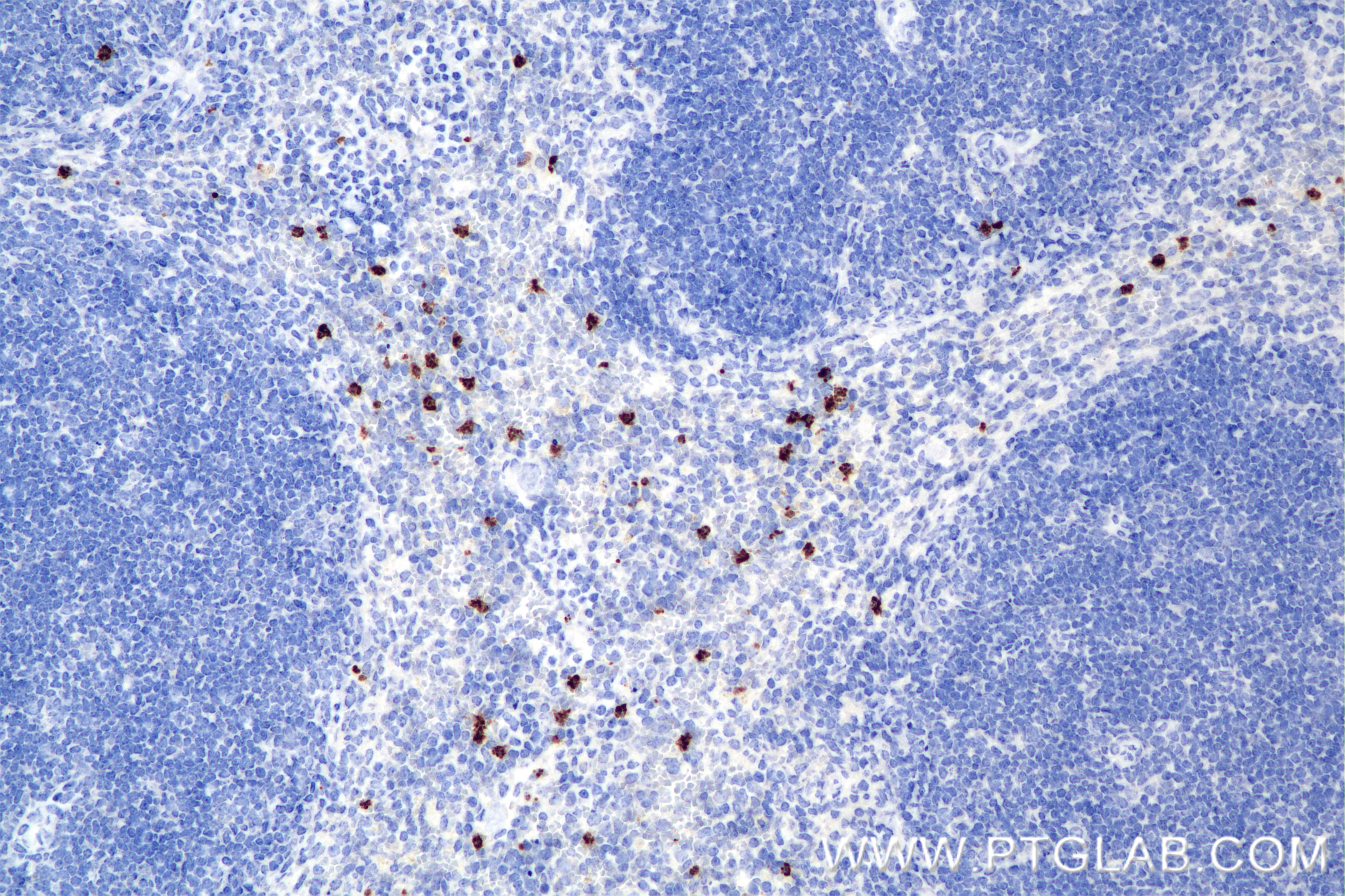 Immunohistochemistry (IHC) staining of mouse spleen tissue using MMP8 Recombinant monoclonal antibody (85211-4-RR)