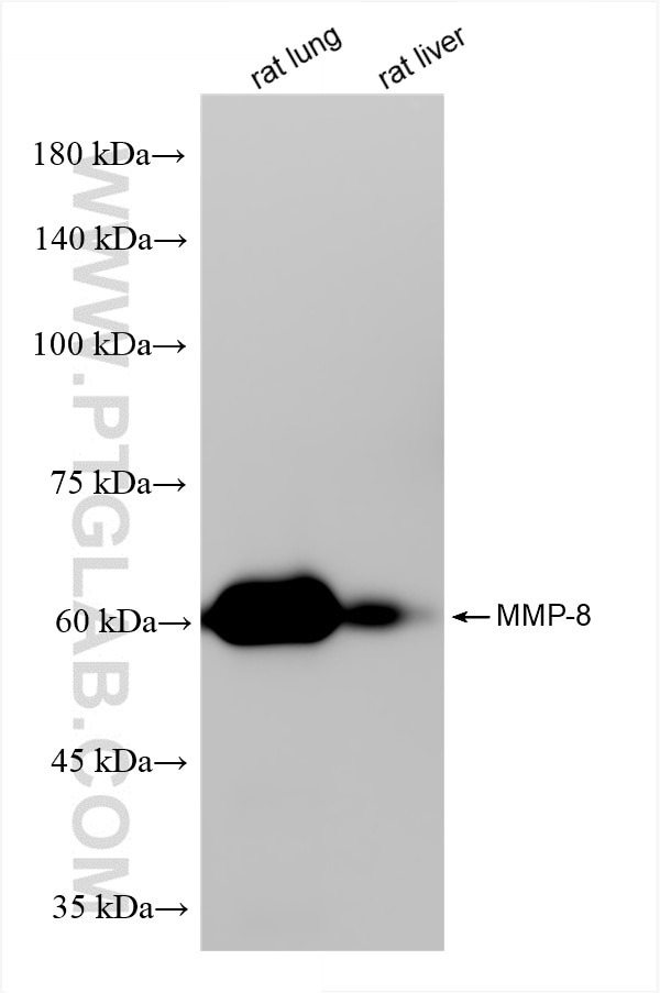 Western Blot (WB) analysis of various lysates using MMP8 Recombinant antibody (85211-4-RR)