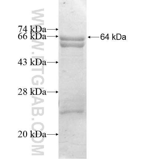 MMP8 fusion protein Ag12367 SDS-PAGE