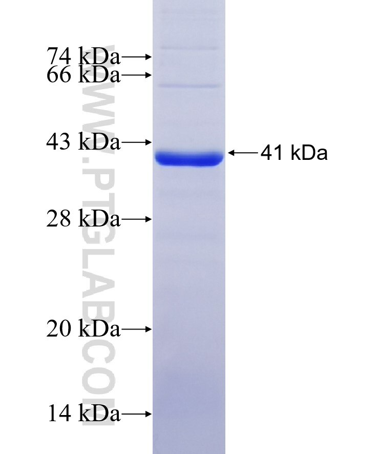 MMP8 fusion protein Ag12616 SDS-PAGE