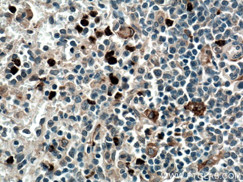 Immunohistochemistry (IHC) staining of human spleen tissue using MMP9 (Middle) Polyclonal antibody (27306-1-AP)