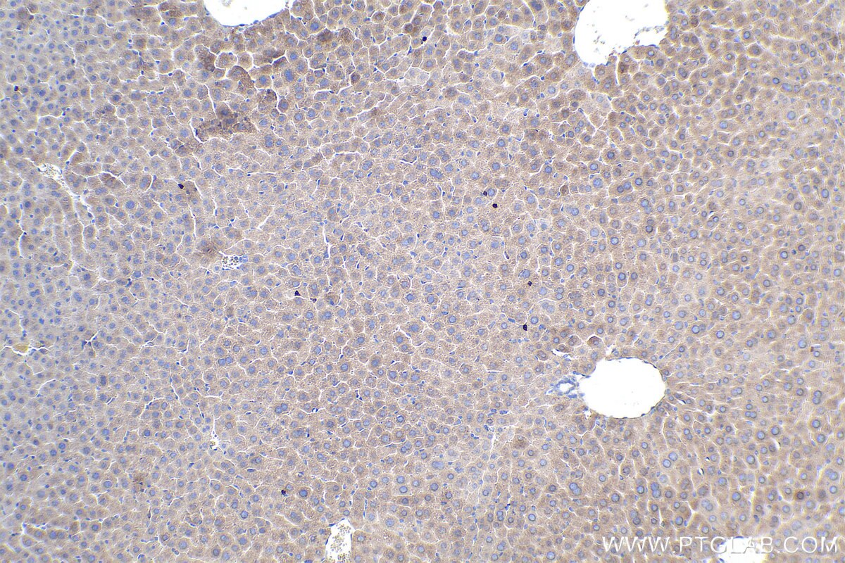 Immunohistochemistry (IHC) staining of mouse liver tissue using MMP9 (Middle) Polyclonal antibody (27306-1-AP)