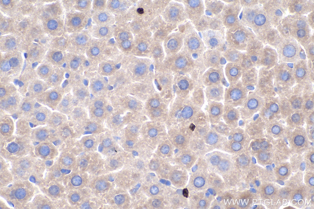 Immunohistochemistry (IHC) staining of mouse liver tissue using MMP9 (Middle) Polyclonal antibody (27306-1-AP)