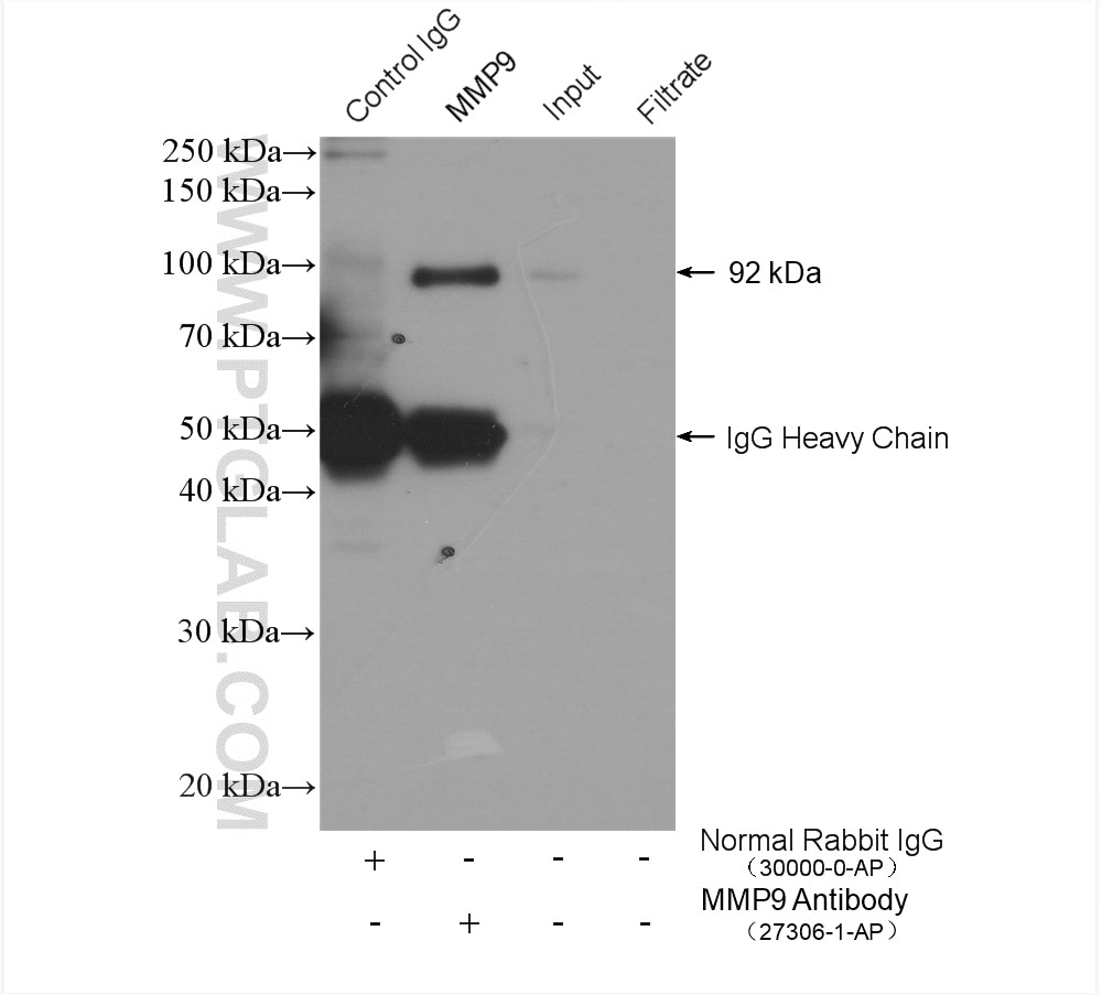 Immunoprecipitation (IP) experiment of human saliva using MMP9 (Middle) Polyclonal antibody (27306-1-AP)