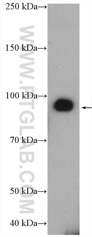 Western Blot (WB) analysis of human saliva using MMP9 (Middle) Polyclonal antibody (27306-1-AP)