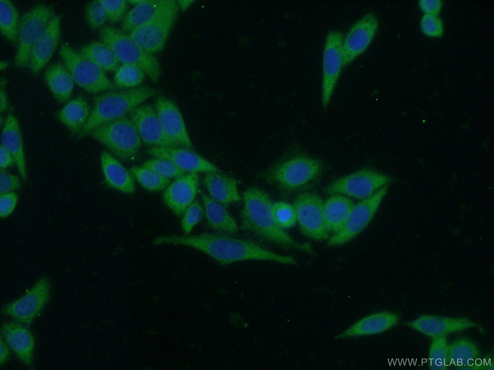 Immunofluorescence (IF) / fluorescent staining of HeLa cells using MMP9 (N-terminal) Polyclonal antibody (10375-2-AP)