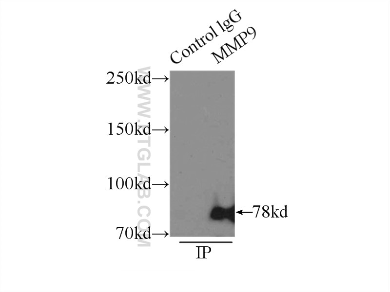 MMP9 (N-terminal) Polyclonal antibody