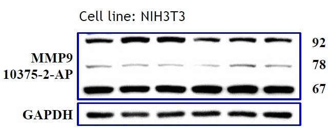 MMP9 (N-terminal) Polyclonal antibody