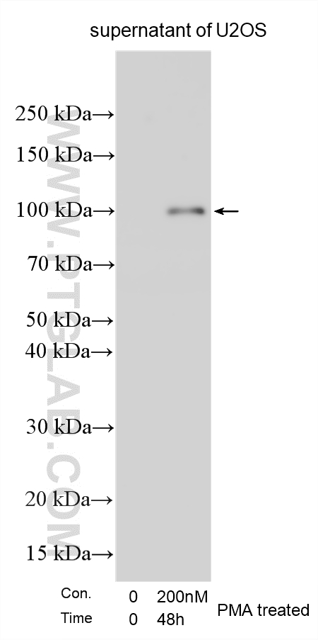 Western Blot (WB) analysis of various lysates using MMP-9 (N-terminal) Polyclonal antibody (10375-2-AP)