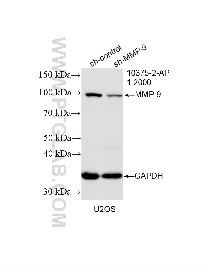 WB result of MMP-9 (N-terminal) antibody (10375-2-AP; 1:2000; incubated at room temperature for 1.5 hours) with sh-Control and sh-MMP-9 (N-terminal) transfected U2OS cells. Western Blot (WB) analysis of U2OS cells using MMP-9 (N-terminal) Polyclonal antibody (10375-2-AP)