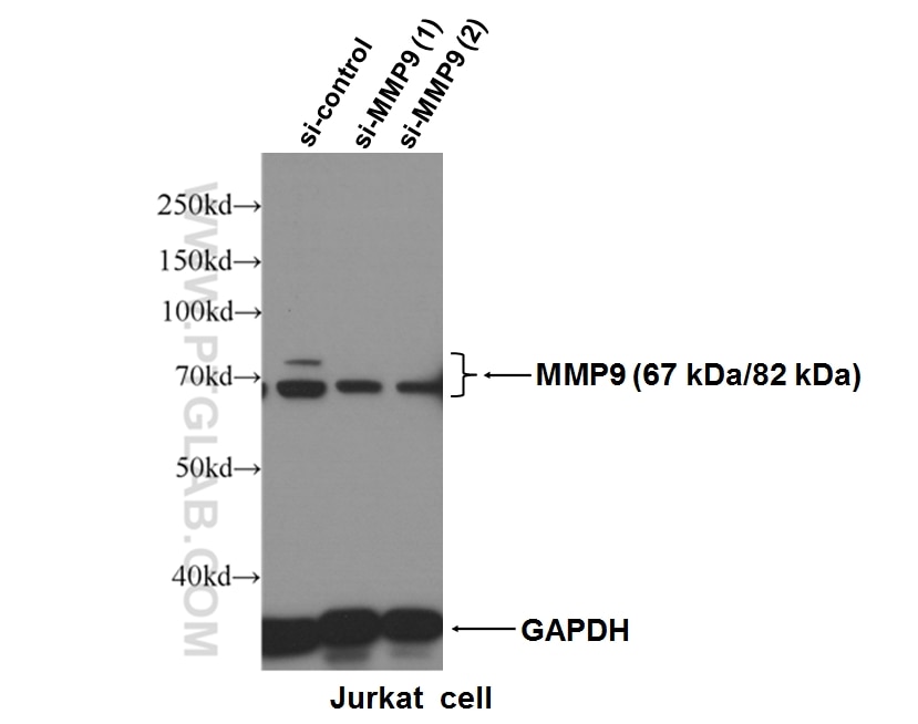 Western Blot (WB) analysis of Jurkat cells using MMP9 (N-terminal) Polyclonal antibody (10375-2-AP)