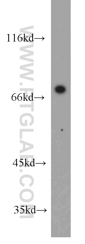MMP9 (N-terminal) Polyclonal antibody
