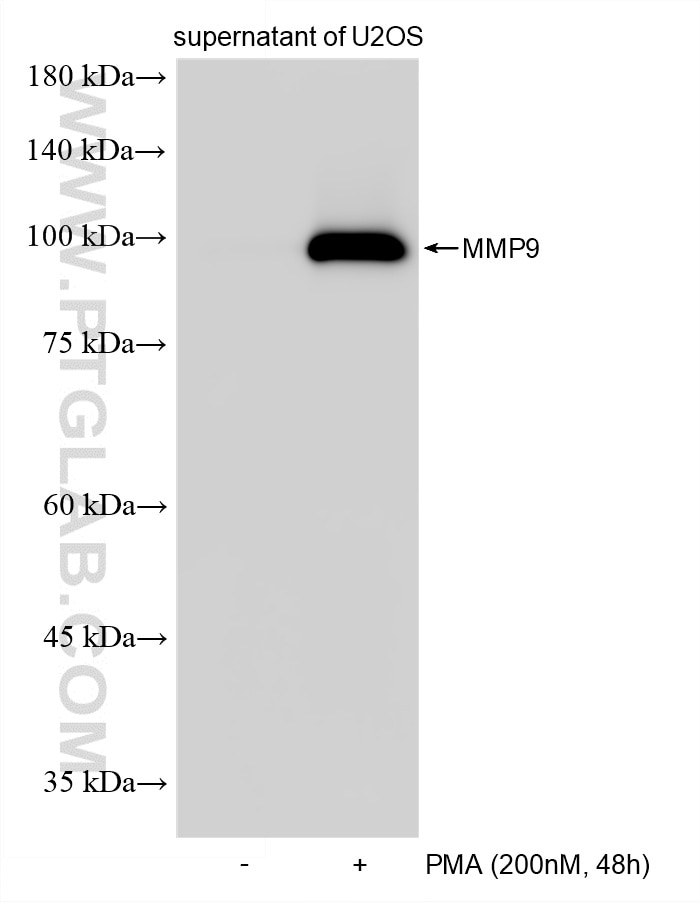 Western Blot (WB) analysis of supernatant of U2OS cells using MMP-9 Recombinant monoclonal antibody (82685-20-RR)