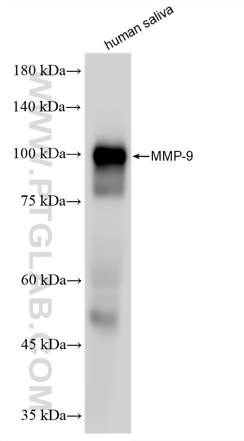 Western Blot (WB) analysis of human saliva using MMP-9 Recombinant monoclonal antibody (82685-20-RR)