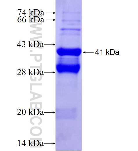MMP9 fusion protein Ag26132 SDS-PAGE