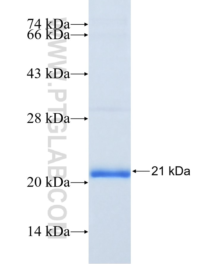 MMP9 fusion protein Ag26140 SDS-PAGE