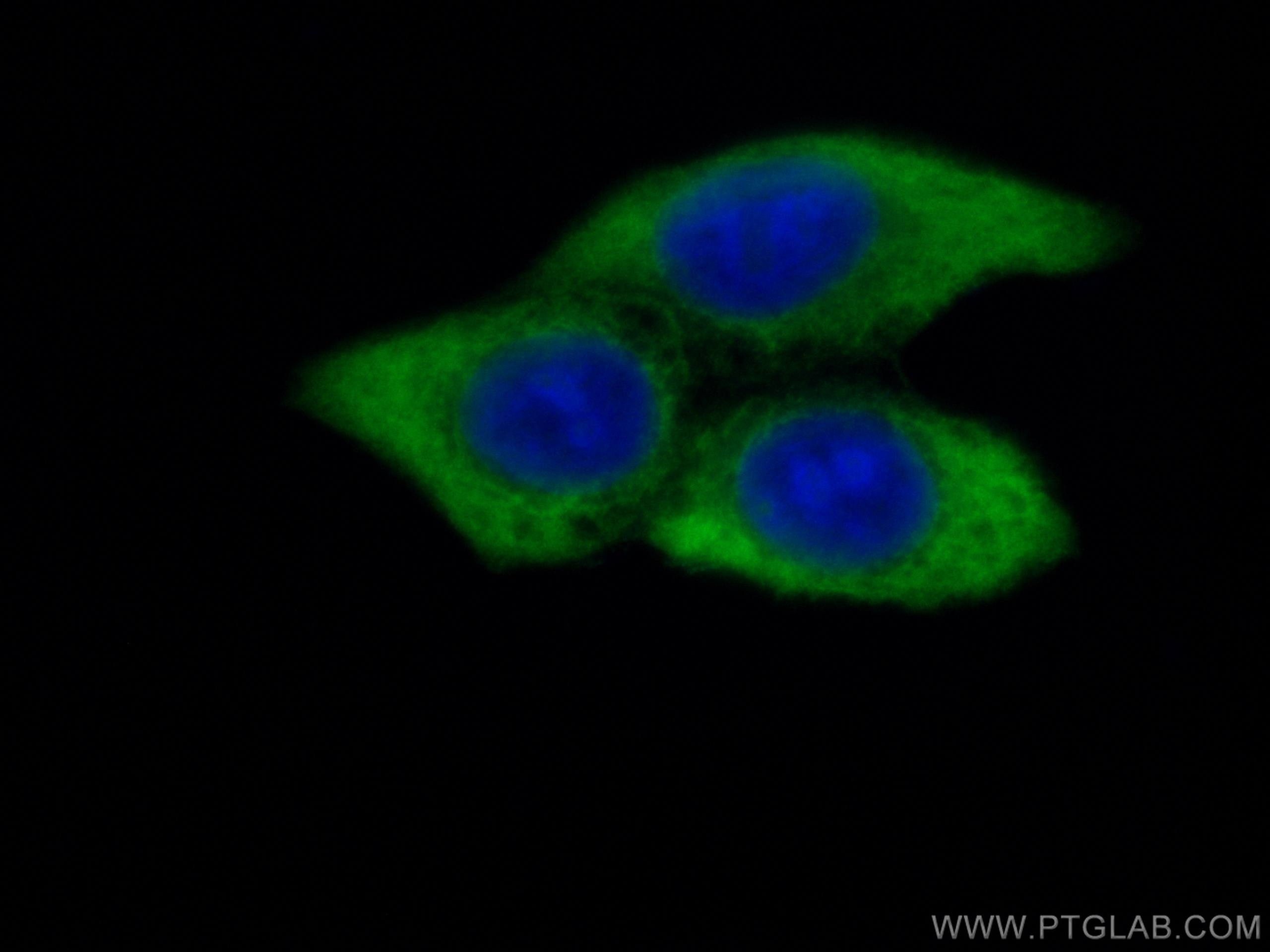 Immunofluorescence (IF) / fluorescent staining of MCF-7 cells using CoraLite® Plus 488-conjugated MMP9 (N-terminal) Po (CL488-10375)