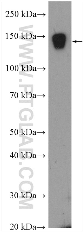 Western Blot (WB) analysis of human peripheral blood platelets using MMRN1 Polyclonal antibody (17878-1-AP)