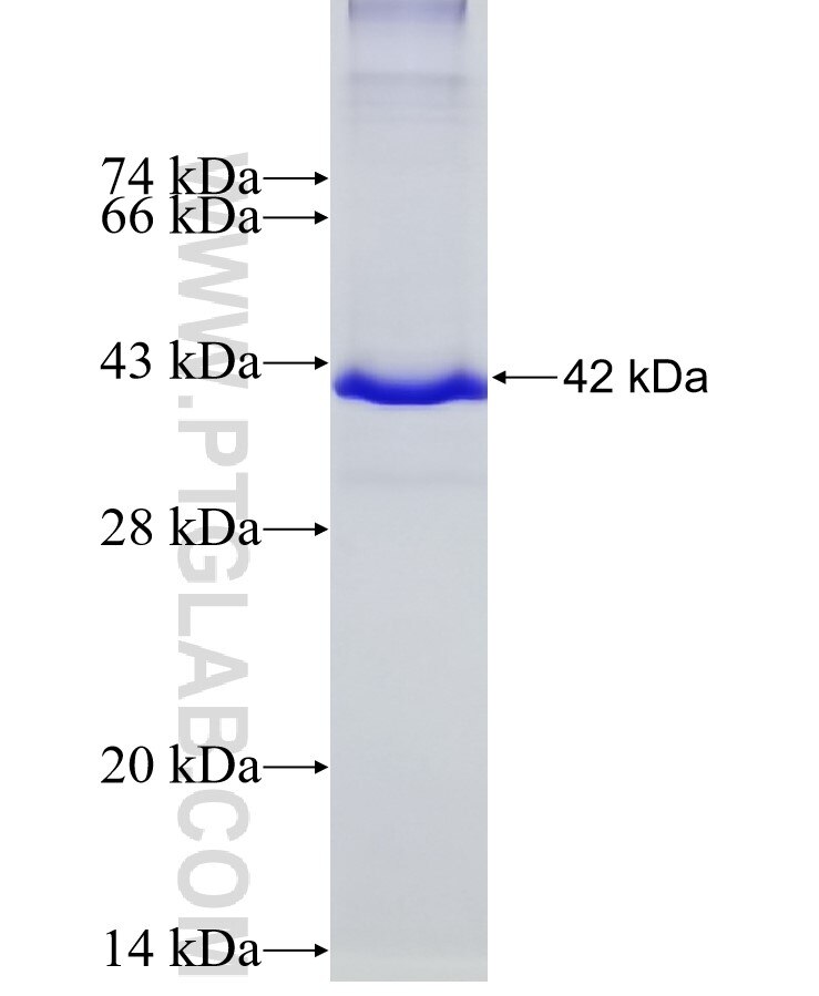MMRN1 fusion protein Ag11739 SDS-PAGE